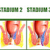Obat Wasir (Hemoroid) Parah Manjur Terdaftar BPOM thumbnail