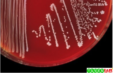 Example of white colonies of coagulasenegative staphylococci on blood agar. Example of white colonies of coagulasenegative staphylococci on blood agar.