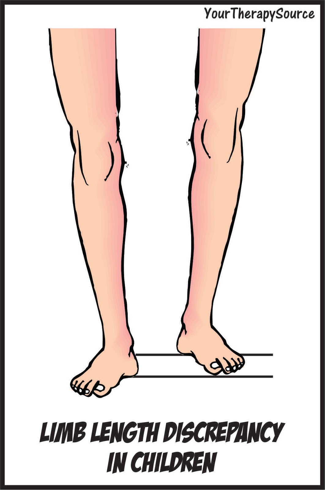 limb-length-discrepancies-your-therapy-source-www-yourtherapysource