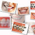Niềng răng khắc phục vấn đề khiếm khuyết răng