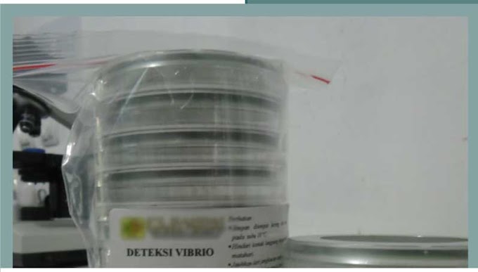 Deteksi Vibrio