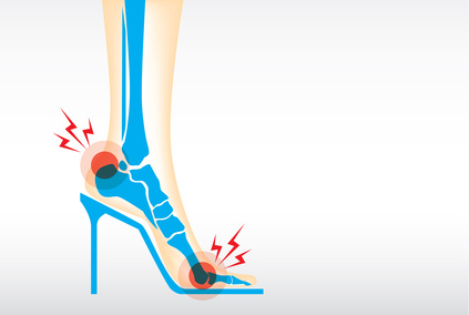 Heel Fat Pad Syndrome: Symptoms, Causes & Treatment