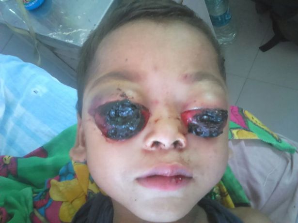 NGERI! Mata Menonjol Seperti Mau Keluar, Ternyata Inilah Gejala Awalnya NGERI! Mata Menonjol Seperti Mau Keluar, Ternyata Inilah Gejala Awalnya