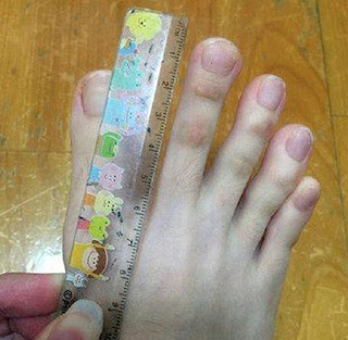 بالصور.. فتاة من تايوان تحير الجميع بأصابع قدميها!