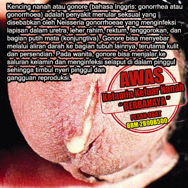 Ramuan Tradisional Cara Mengatasi Kencing Nanah Ramuan Tradisional Cara Mengatasi Kencing Nanah