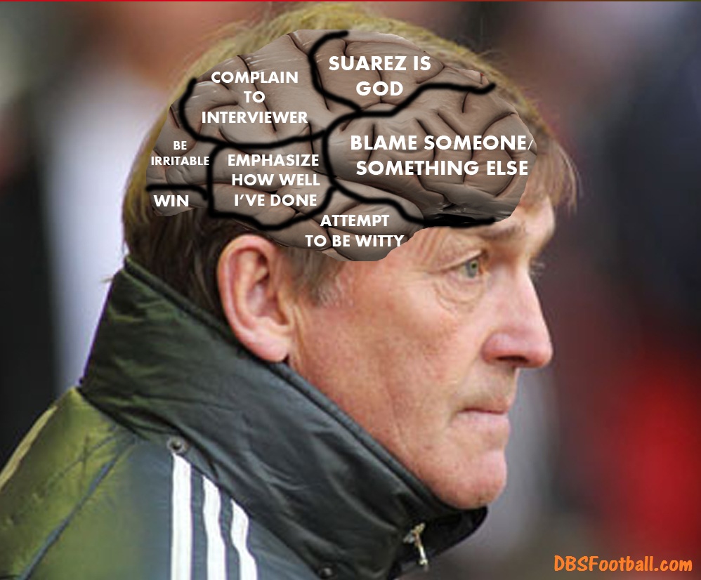 dalglish+brain.jpg