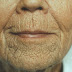 Anti-Aging: The Practitioner's View