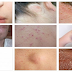 10 Signs That Cancer Is Already Growing In Your Body