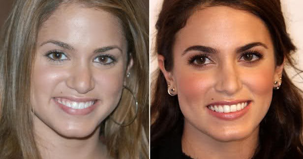 Chatter Busy: Nikki Reed Nose Job