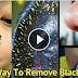 How To Eliminate Black Heads Overnight With These Ingredients