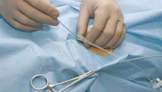 Benjamin Franklin Seorang Penemu Pipa Kateter Medis