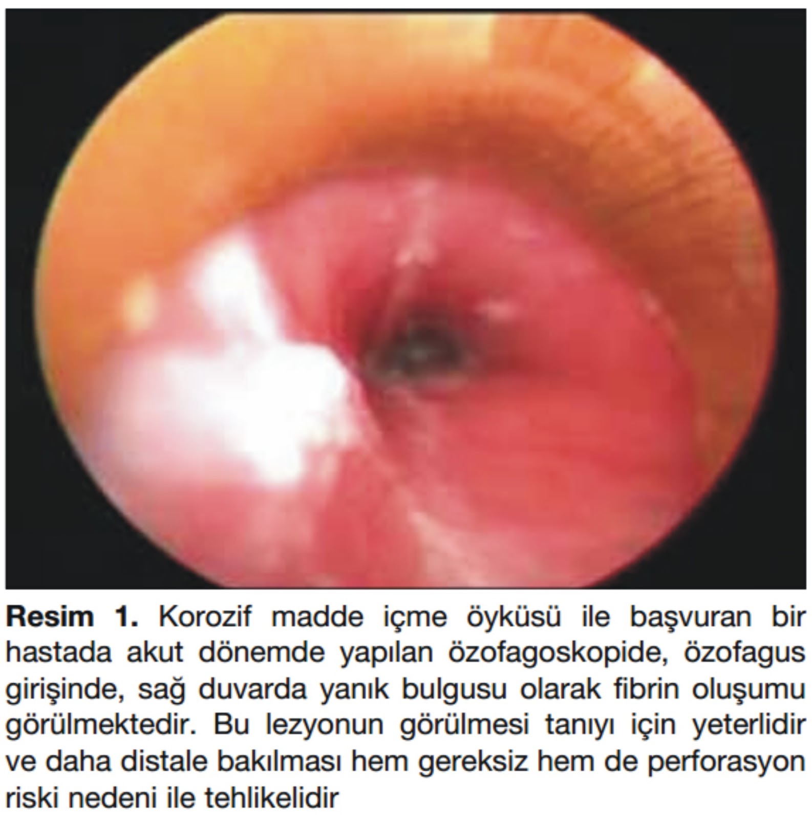 Ülser neden olur ile Etiketlenen Konular Ülser neden olur ile Etiketlenen Konular