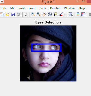 eyes detection in matlab step by step explanation with source code