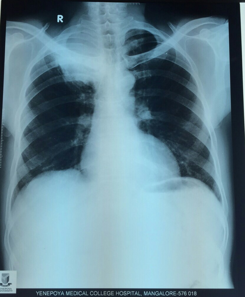 Chest Medicine Made EasyDr Deepu SPOTTER GIVE YOUR DIAGNOSIS