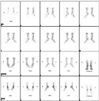 Nuclear Medicine Exams Explained - For The Patient: Nuclear Medicine ...