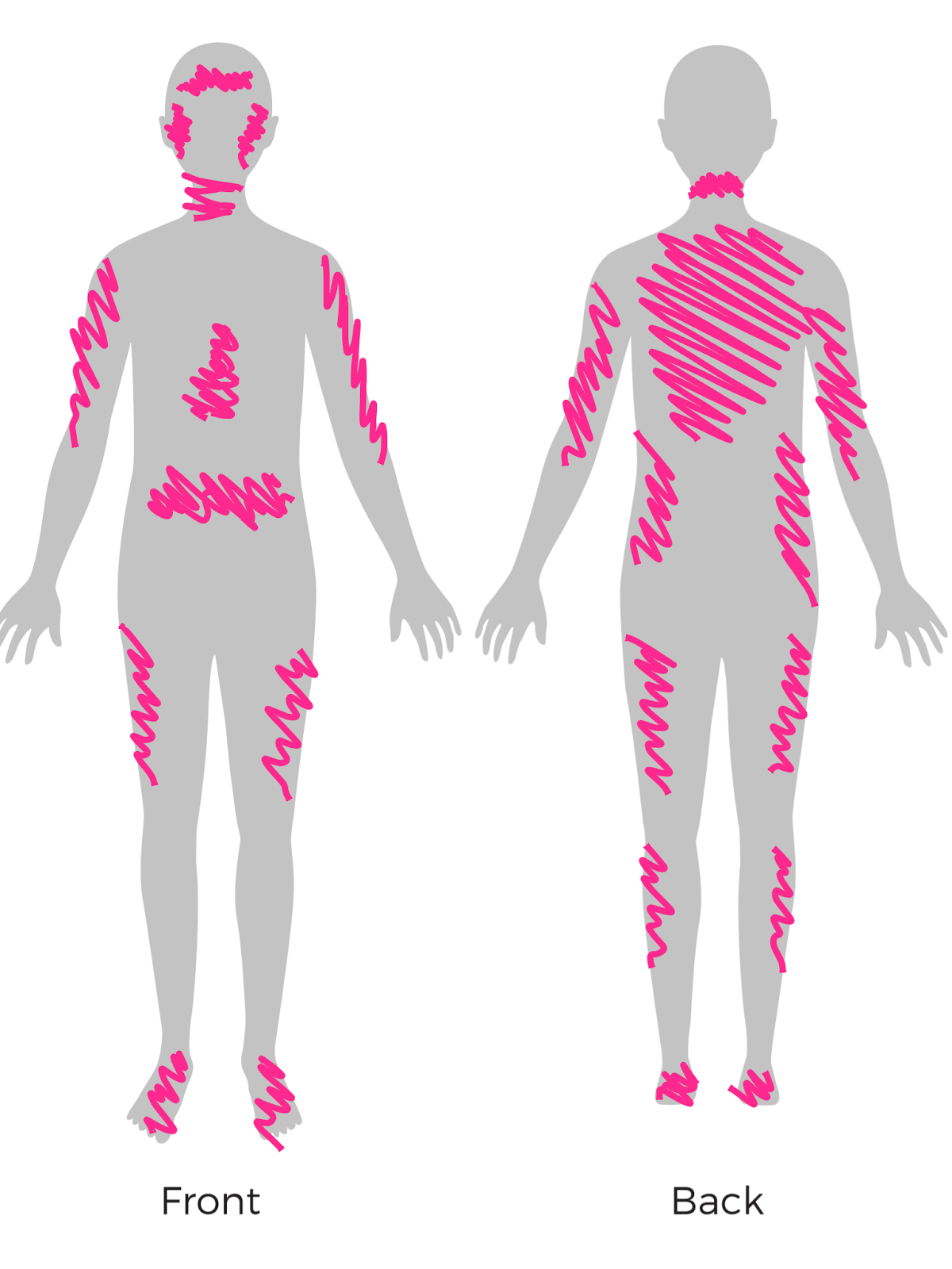 epaderm ointment psoriasis