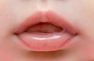   boca salivando, como parar de salivar, excesso de saliva na gravidez, sialorreia, salivação excessiva na gravidez, estomatite