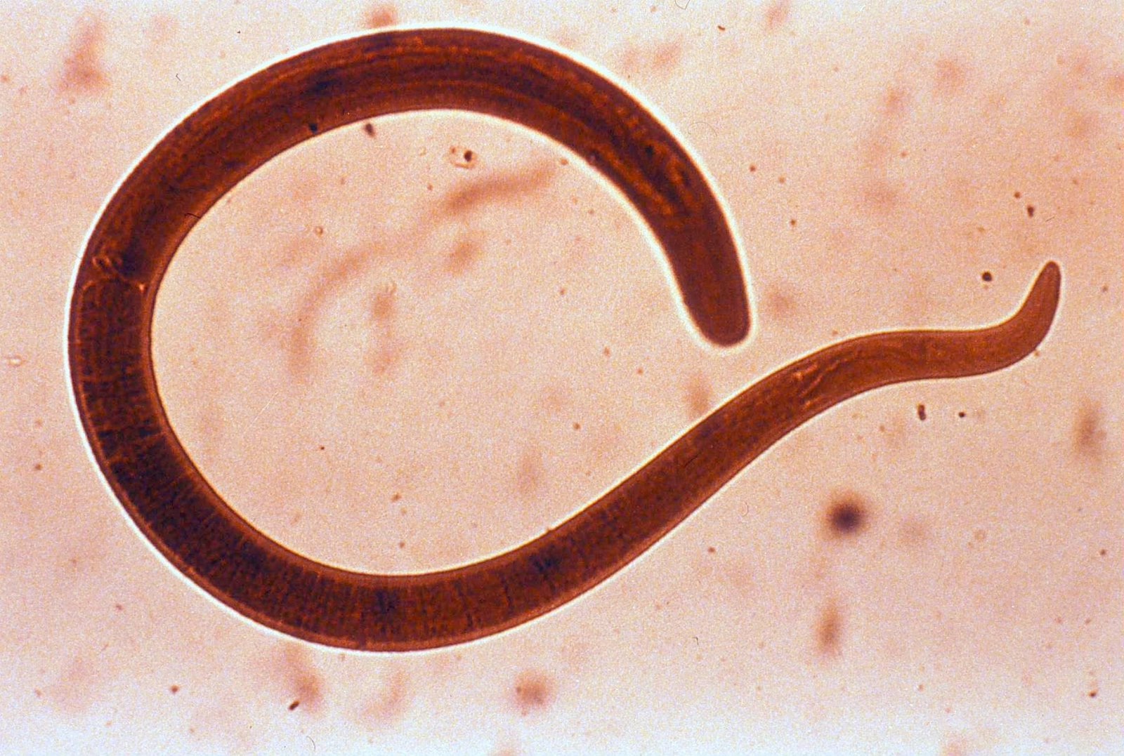 В какой среде обитает червь паразит. Анкилостома геогельминты. Нематода Caenorhabditis elegans. Кошачьи глисты анкилостома.