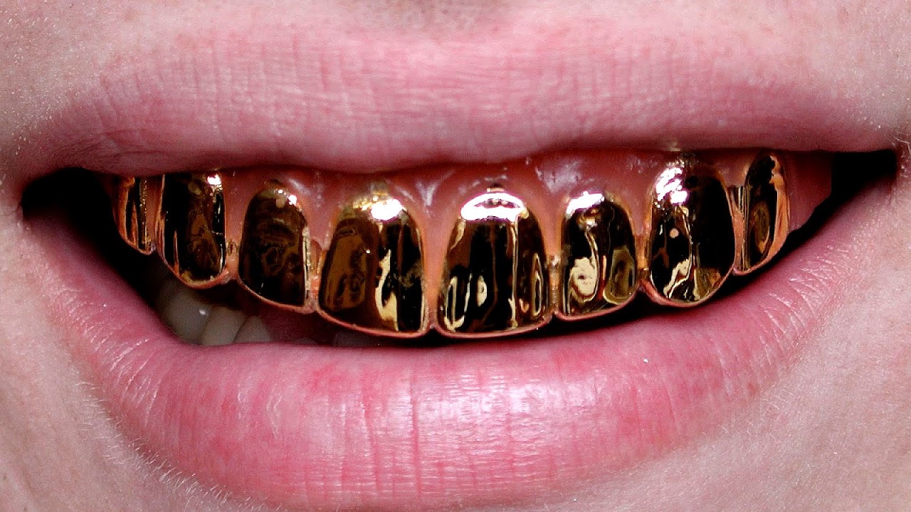 Permanent Gold Teeth Procedure Gold Choices