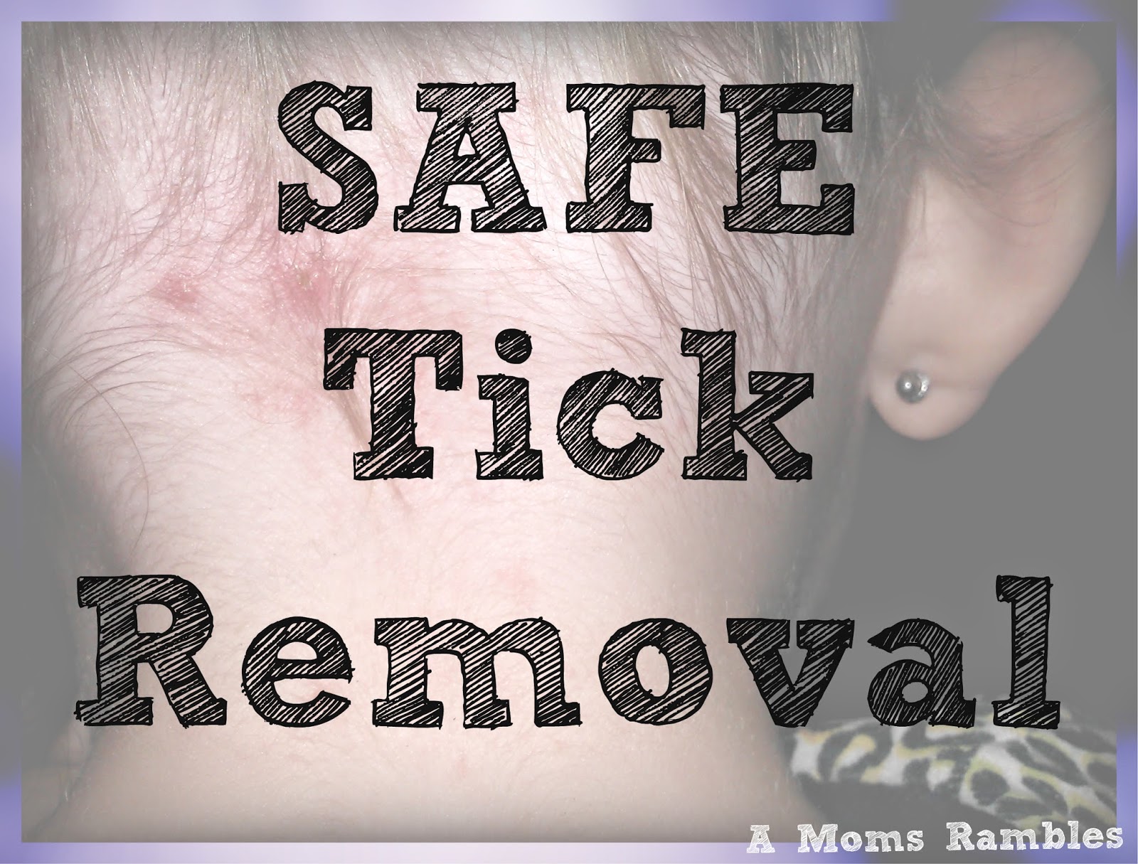 A Mom's Rambles Tick Season, Safe Removal; What You Need to Know