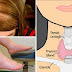 Order These Tests IMMEDIATELY If You Show Any of These 68 Signs of Hypothyroidism