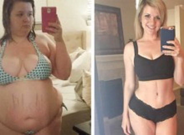 SE CANSÓ DE LA OBESIDAD QUE TENÍA Y SE PUSO A DIETA. PERDIÓ 70 KG PERO SU NOVIO SE PUSO CELOSO. SE CANSÓ DE LA OBESIDAD QUE TENÍA Y SE PUSO A DIETA. PERDIÓ 70 KG PERO SU NOVIO SE PUSO CELOSO.