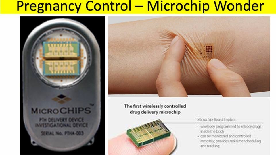 amudu Pregnancy MICRO CHIP Birth control in a click of a button