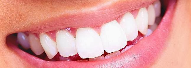 Moda, Sauld y Belleza. Dientes blancos