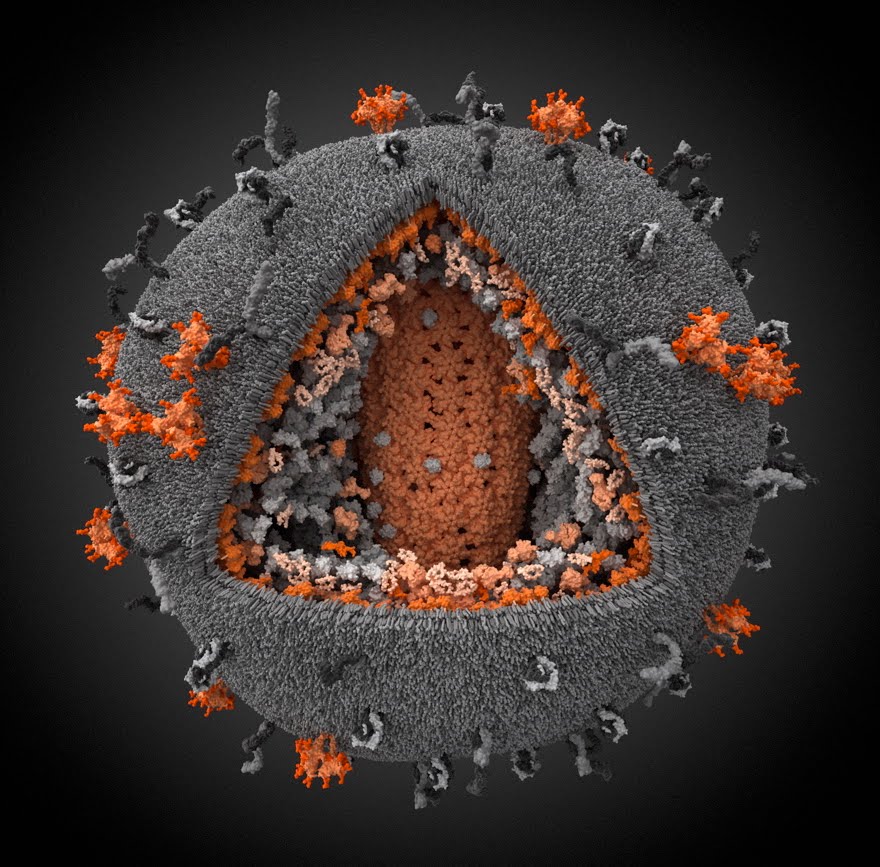 Human immunodeficiency. Вирус ВИЧ под микроскопом. Вирус иммунодефицита человека электронный микроскоп. Вирус иммунодефицита под микроскопом. Вирус иммунодефицита (ВИЧ).