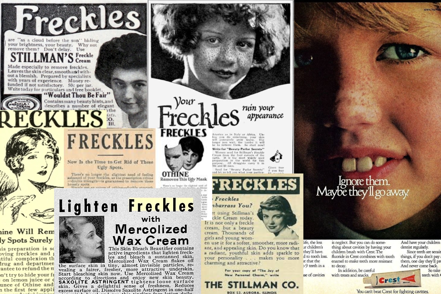 anti freckles vintage retro advertisement