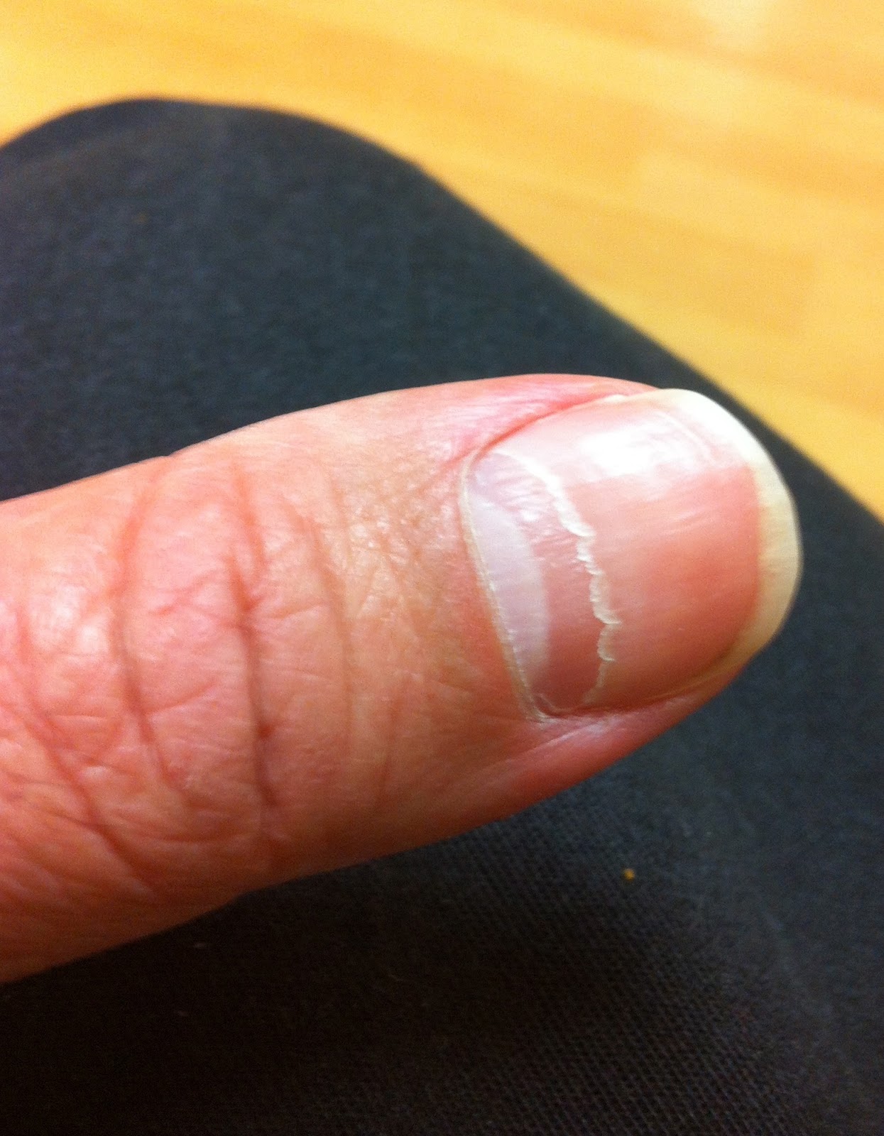 Thrilled to Death Paul Pavao's Leukemia Blog Day a Lot