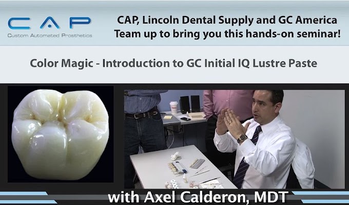 VIDEOCONFERENCING: Stain and Glaze CAP FZ full contour zirconia using GC Initial IQ Lustre Paste NF (Video 2)