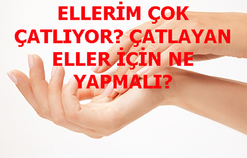 Ellerim Cok Catliyor Catlayan Eller Icin Ne Yapmali