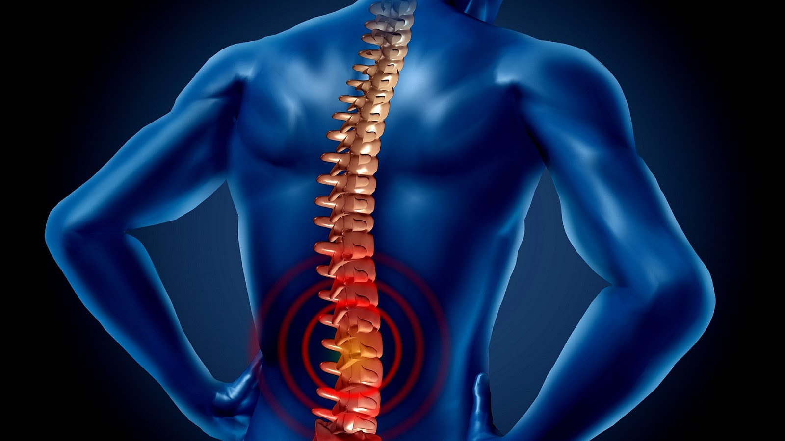 Lower Back Injury Injury Choices