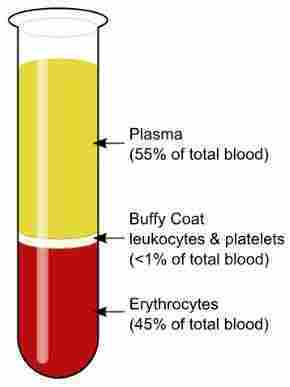 Komponen terbesar yang menyusun plasma darah adalah