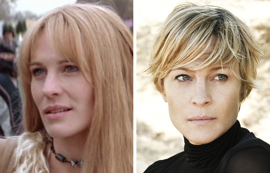 Robin Wright Plastic Surgery