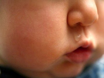 Viêm tiểu phế quản ở trẻ nhỏ có thể gây suy hô hấp nặng