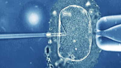 Disuntik sperma membuahi telur dalam ICSI, jenis IVF
