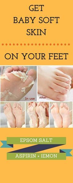 Get Smooth Baby Soft Skin On Your Feet, No Dry Skin Or Cracks Anymore