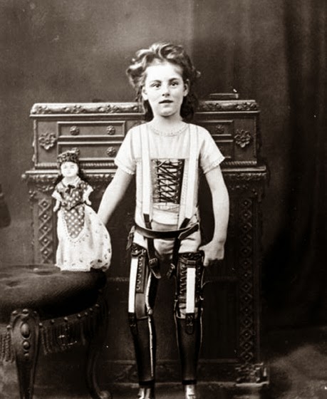 64 Historical Pictures you most likely haven’t seen before. # 8 is a bit disturbing! 15. A kid with his artificial legs, 1898