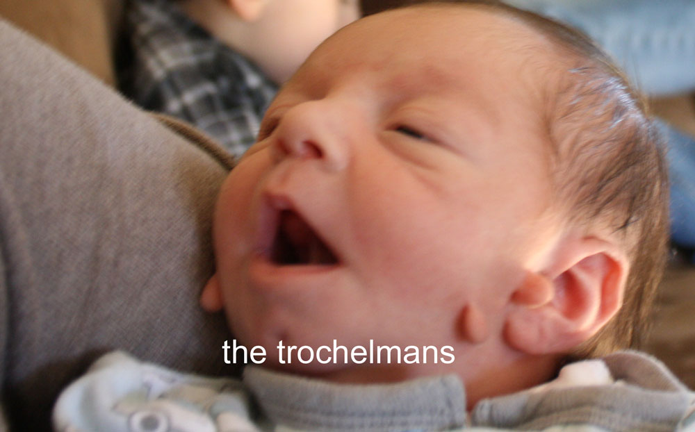 the trochelmans Skin tag removal on our baby