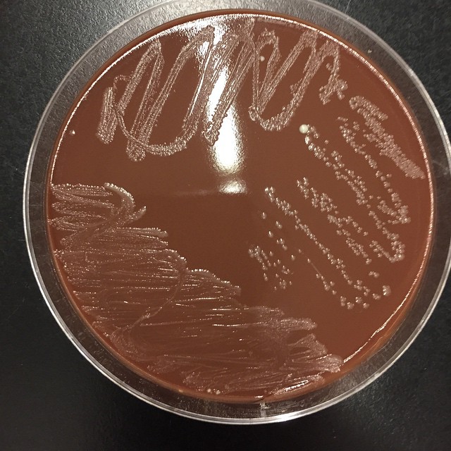 Chocolate Agar Principles Composition, Preparation uses and colony