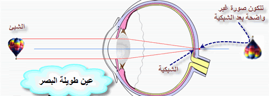 علامات تحرك اللولب عالم حواء الحلبه