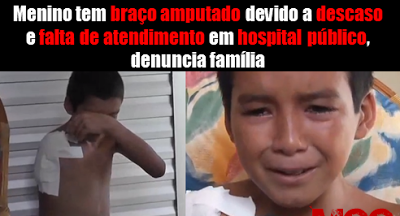 Menino teve braço amputado