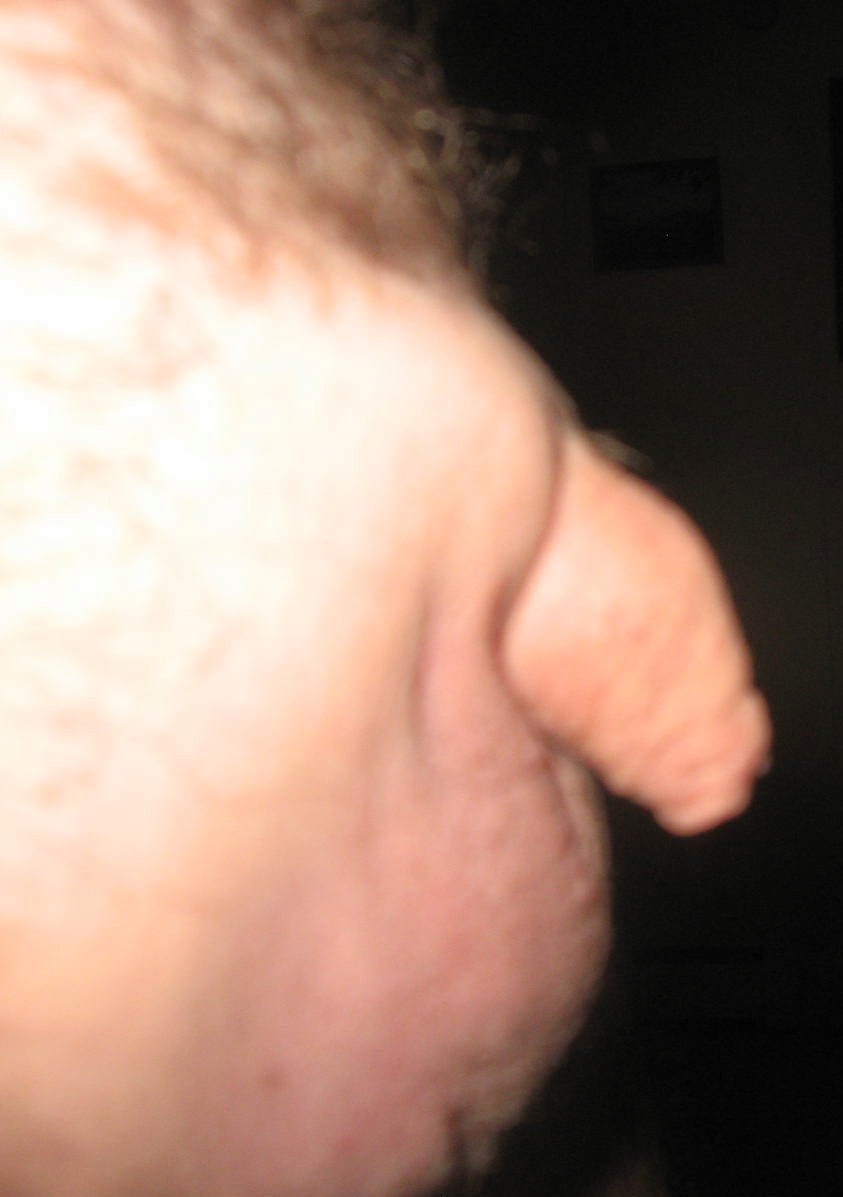 Pictures Of A Small Penis 59