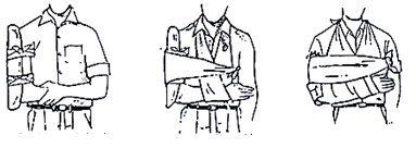 PEMBALUTAN LUKA KEPALA, MATA (MUKA), TANGAN DAN KAKI