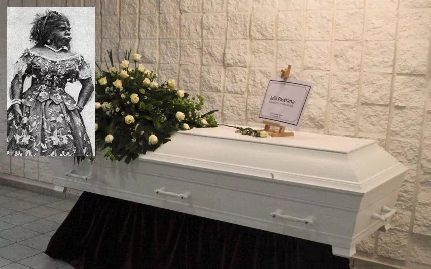 Kisah Mengharukan Wanita Terjelek di Dunia Kisah Mengharukan Wanita Terjelek di Dunia