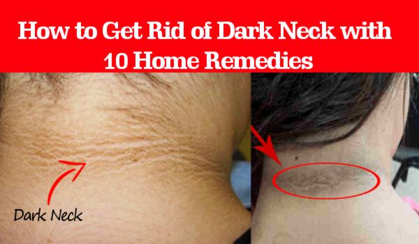 How To Get Rid Of Black On The Neck لم يسبق له مثيل الصور Tier3 Xyz