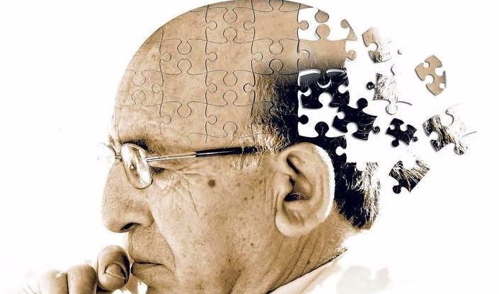 Alzheimer stimolato dalla scarsa igene orale | Salute News.