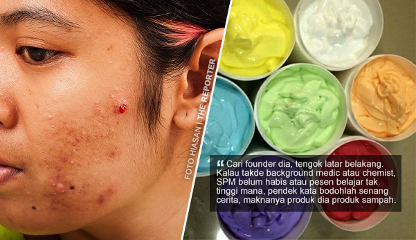 "Pakai dua minit dah putih. Pakai seminggu dah naik urat hijau" - Khairul Yoi ajar cara nak kenal pasti produk sampah krim kilo